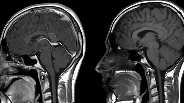 What Beatboxing Looks Like Through an MRI Scanner